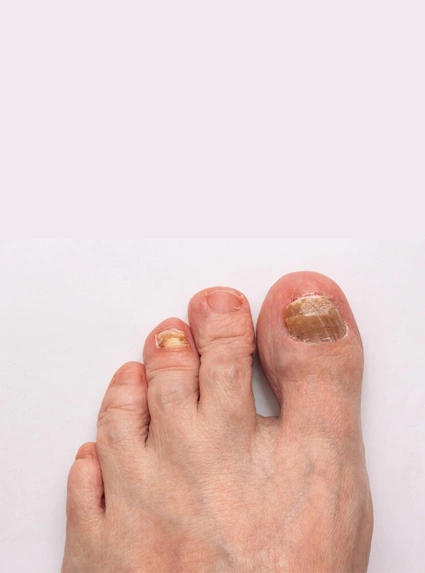 Ayak Bakımı Nasıl Yapılır