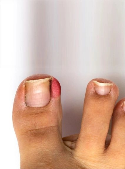 Ayak Bakımının Faydaları