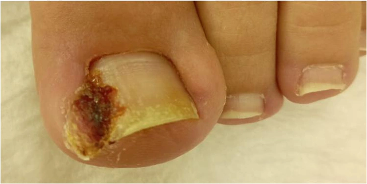 Beylikdüzü Medikal Ayak Bakımı