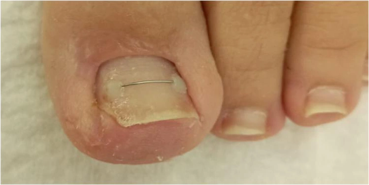 Beylikdüzü Medikal Ayak Bakımı