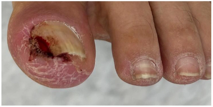 Bahçeşehir Medikal Ayak Bakımı