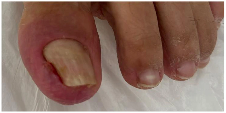 Bahçeşehir Medikal Ayak Bakımı