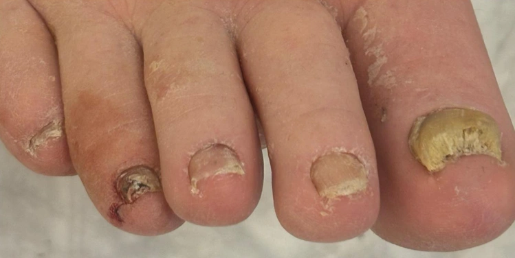 Beykent Medikal Tırnak Bakımı