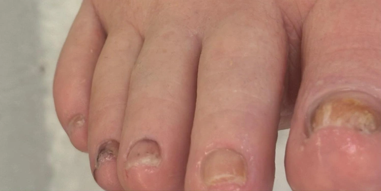 Beykent Medikal Tırnak Bakımı