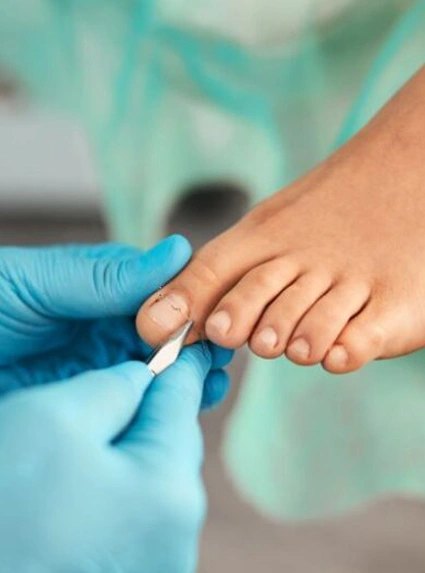 Tırnak Batması Sorunu